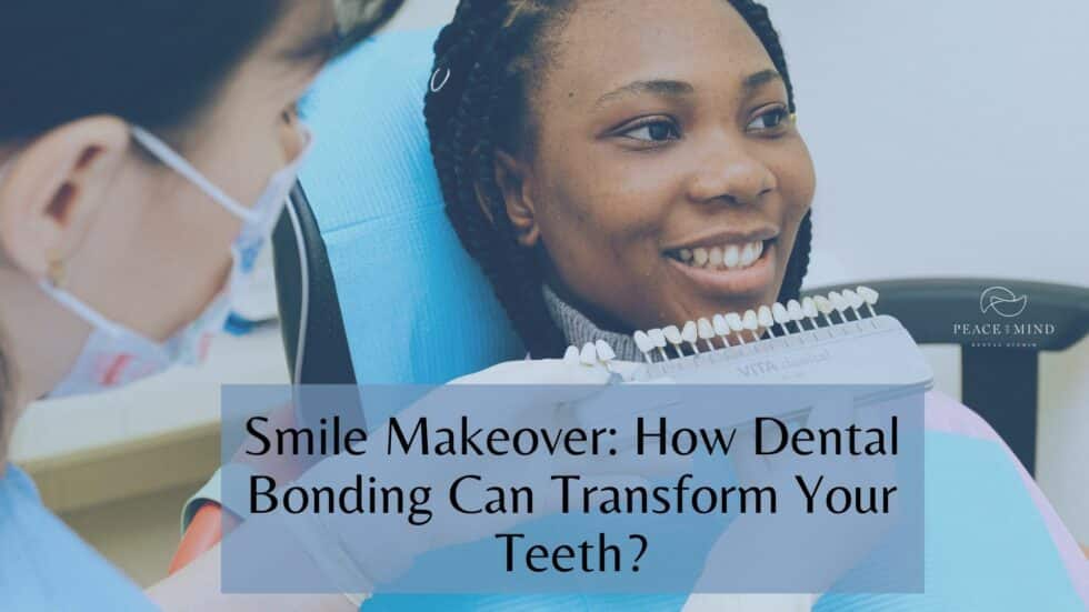 Smile Makeover: How Dental Bonding Can Transform Your Teeth?